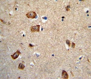 Integrin alpha 1 Antibody