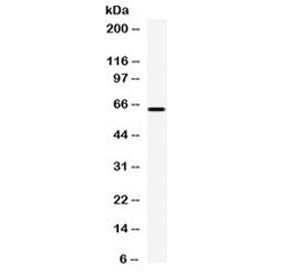 Carboxypeptidase M Antibody (CPM)
