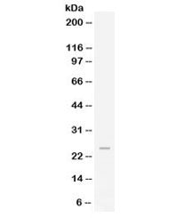 Western blot testing of human HeLa lysate with FGF19 antibody at 0.5ug/ml. Predicted/observed molecu