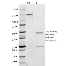 SDS-PAGE analysis of purified, BSA-free Interferon gamma antibody (clone G-23) as confirmation of in