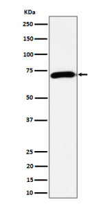 Western blot analysis of Choline Acetyltransferase expression in mouse brain cell lysate using CHAT antibody. Predicted molecular weight ~74 kDa.