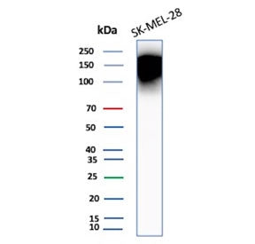 Western blot testing of human SK-MEL-28 cell lysate with CEACAM1 antibody (clone CEACAM1/12659). Pre