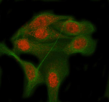 Immunofluorescent staining of RBM12B using anti-RBM12B antibody (red) and anti-Beta Tubulin antibody