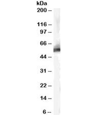 Western blot testing of human liver lysate with MDM2 antibody at 0.3ug/ml. Predicted molecular weigh
