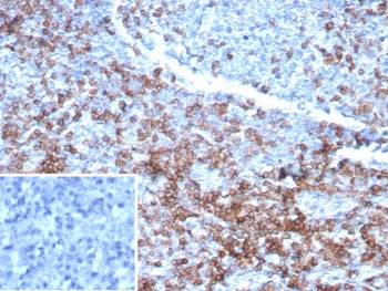 IHC staining of FFPE human lymph node tissue with CD3e antibody (clone rC3e/6967). Inset: PBS used i