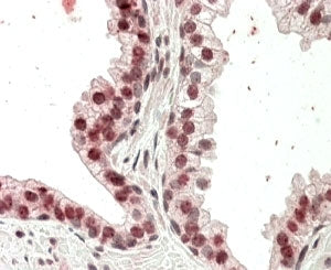 IHC testing of FFPE human prostate with HOXD13 antibody at 4ug/ml. HIER: steamed with pH6 citrate bu
