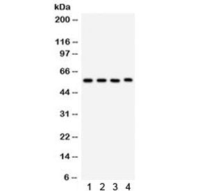 Western blot testing of 1) rat lung, 2) mouse lung, 3) human placenta, 4) Jurkat lysate with CYP1A1 