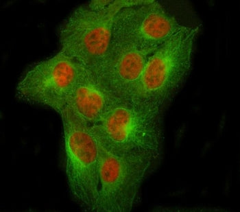 NCOR2 Antibody / Nuclear receptor corepressor 2 / SMRT
