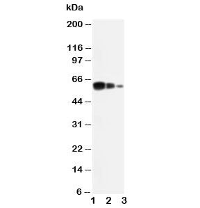 Western blot testing of ADAM10 antibody and Lane 1: recombinant human protein 10ng; 2: 5ng; 3: 2.5ng