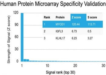 Analysis of HuProt(TM) microarray containing more than 19,000 full-length human proteins using recom