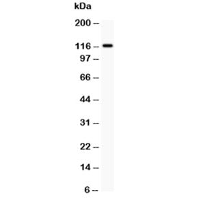 Western blot testing of c-Kit antibody and HEPG2 lysate. Observed molecular weight: ~120/145kDa (pre