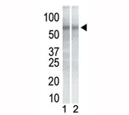 Western blot testing of mouse NIH3T3 cell lysate (Lane 1) and human K562 cell lysate (2) with CHK1 a