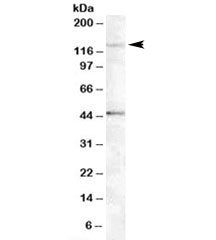Western blot testing of Jurkat lysate with Tankyrase 2 antibody at 0.5ug/ml. The expected ~125kDa ba