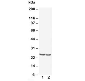 Western blot testing of TIMP4 antibody and Lane 1: rat kidney; 2: human MCF-7; Predicted/observed mo
