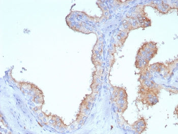 IHC staining of FFPE human prostate tissue with CD107a antibody (clone LAMP1/7457). HIER: boil tissu