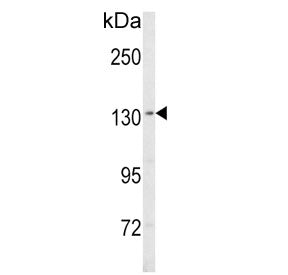 Western blot testing of human MDA-MB-435 cell lysate with SREBF1 antibody. Predicted molecular weigh