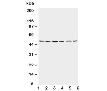 Western blot testing of Presenilin 2 antibody and Lane 1: rat brain; 2: rat brain; 3: MCF-7; 4: HeLa