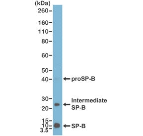 Western blot testing of human lung tissue lysate with recombinant SP-B antibody at 1:1000.