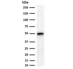 Western blot testing of human thymus tissue and HCT-116 cell lysate with CK15 antibody (clone CTKN15