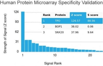 Thyroid Peroxidase Antibody