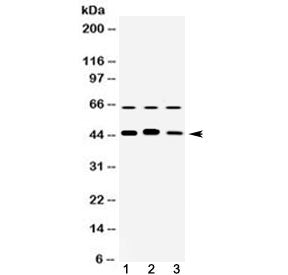 ARFGAP1 Antibody