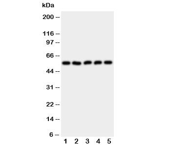 Western blot testing of HYAL2 antibody and Lane 1: HeLa; 2: SMMC-7721; 3: COLO320; 4: MCF-7; 5: HT10