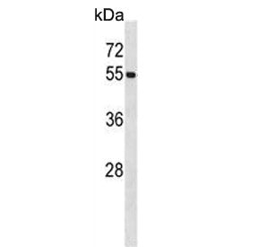 Western blot testing of human HL60 cell lysate with UBA3 antibody. Expected molecular weight ~52 kDa