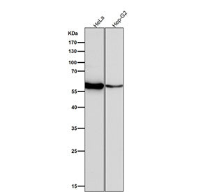 Western blot testing of human samples using the LYN antibody at 1:1000 dilution for 1 hour at room t