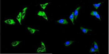 Immunofluorescent staining of FFPE human U-2 OS cells with RENT3A antibody (green) and DAPI nuclear 