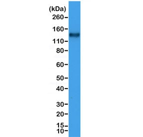 Western blot testing of human Jurkat cell lysate with recombinant CD31 antibody at 1:1000. Expected 