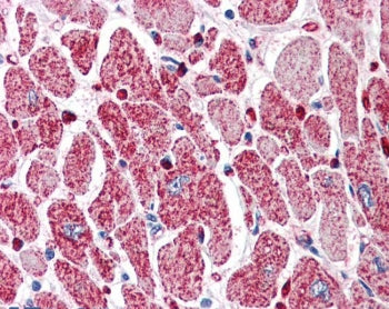 IHC testing of FFPE human heart with PIK3C2A antibody at 5ug/ml. HIER: steamed with pH6 citrate buff