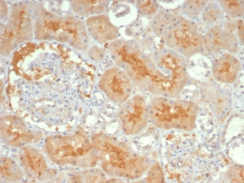 IHC staining of FFPE human kidney tissue with Adenylyl cyclase 8 antibody (clone ADCY8/7341). HIER: 