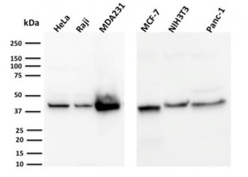 PD-L1 Antibody / B7-H1 / CD274