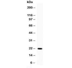 Western blot testing of 0.5ng/lane of rat IFNg recombinant protein with rat Interferon gamma antibod