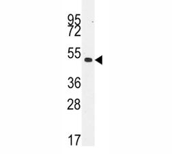 Desmin Antibody (Muscle cell marker)