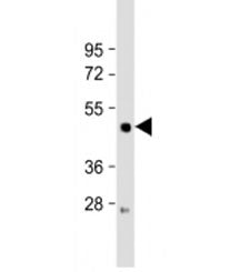 LIPF Antibody / Gastric Lipase