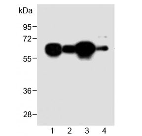 METTL14 Antibody (N-Terminal Region)
