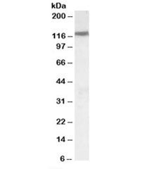 Western blot testing of human heart lysate with SLC12A6 antibody at 0.1ug/ml. Predicted molecular we