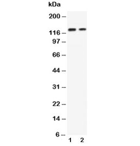 Western blot testing of P-Cadherin antibody and Lane 1: recombinant human protein 10ng; 2: 5ng. Expe