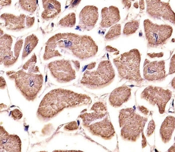 IHC testing of FFPE human heart tissue with IRF7 antibody. HIER: steam section in pH6 citrate buffer
