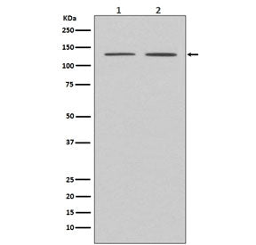 Western blot testing of human 1) HeLa and 2) MCF7 cell lysate with APAF1 antibody. Predicted molecul