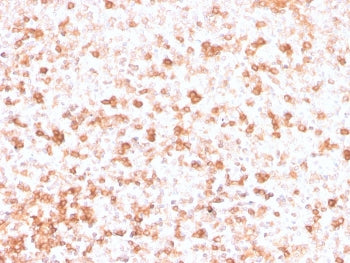 Lambda Light Chain Antibody / Lambda Antibody
