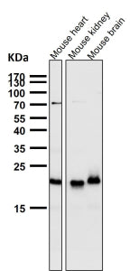 All lanes use the TIMM22 antibody at 1:2000 dilution for 1 hour at room temperature. Predicted molec