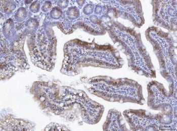 TOX Antibody