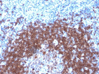 IHC testing of FFPE human tonsil with recombinant CD79a antibody (clone IGA/1790R). Required HIER: b