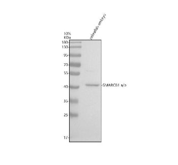 Western blot analysis of SMARCB1a/b protein using Zebrafish Smarcb1 antibody and zebrafish embryo ti