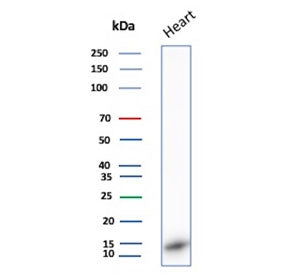 Western blot testing of human heart tissue lysate with FABP3 antibody. Predicted molecular weight ~1