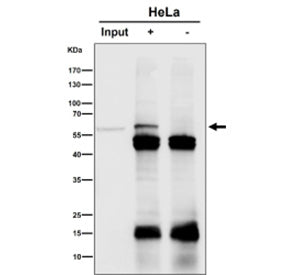 Immunoprecipitation analysis using the antibody at 1:50 dilution. Western blot at 1:1000 dilution. I