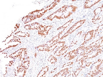 MLH1 Antibody / MutL Homolog 1