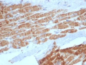 IHC staining of FFPE human heart tissue with SDHA antibody (clone SDHA/7495). HIER: boil tissue sect
